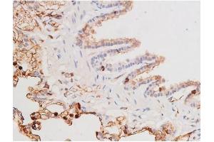 Immunohistochemistry (IHC) image for anti-Mast/stem Cell Growth Factor Receptor (KIT) (pTyr703) antibody (ABIN6255994)