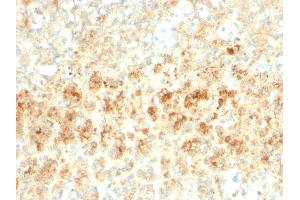 Formalin-fixed, paraffin-embedded human Adrenal Gland stained with Adipophilin Recombinant Rabbit Monoclonal Antibody (ADFP/2755R). (Recombinant ADRP 抗体  (AA 249-376))
