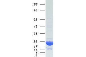 Western Blotting (WB) image for Crystallin, alpha B (CRYAB) protein (Myc-DYKDDDDK Tag) (ABIN2714621)
