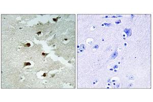 Immunohistochemistry analysis of paraffin-embedded human brain tissue using CDCA4 antibody.