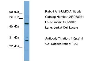 WB Suggested Anti-ULK3  Antibody Titration: 0. (ULK3 抗体  (Middle Region))