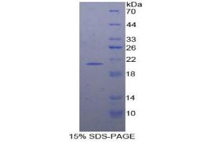 SDS-PAGE analysis of Human Interferon alpha 7 Protein. (IFNA7 蛋白)