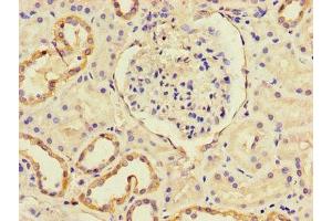 Immunohistochemistry of paraffin-embedded human kidney tissue using ABIN7146119 at dilution of 1:100 (CXCL11 抗体  (AA 22-94))
