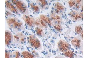 DAB staining on IHC-P; Samples: Human Stomach Tissue (CCL8 抗体  (AA 1-99))