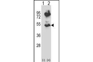 Western blot analysis of HTRA2 (arrow) using rabbit polyclonal HTRA2 Antibody (N-term) (ABIN657628 and ABIN2846624). (HTRA2 抗体  (N-Term))