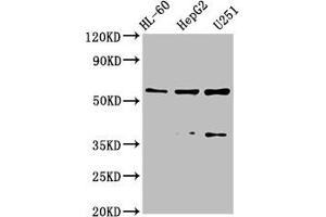 Western Blot Positive WB detected in: HL-60 whole cell lysate, HepG2 whole cell lysate, U251 whole cell lysate All lanes: ENTPD1 antibody at 2. (CD39 抗体  (AA 316-474))
