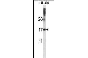 DNAL4 Antibody (N-term) (ABIN657490 and ABIN2846517) western blot analysis in HL-60 cell line lysates (35 μg/lane). (DNAL4 抗体  (N-Term))