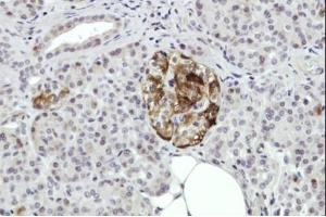 Immunohistochemistry (IHC) image for anti-Annexin A2 (ANXA2) (N-Term) antibody (ABIN2857036)