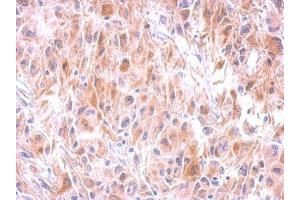 IHC-P Image Immunohistochemical analysis of paraffin-embedded U373 xenograft, using GSTM1, antibody at 1:500 dilution. (GSTM1 抗体  (C-Term))