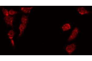 ABIN6269272 staining HepG2 by IF/ICC. (CEBPA 抗体  (N-Term))