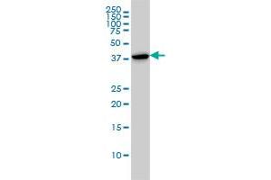 CAPG monoclonal antibody (M01), clone 1F1 Western Blot analysis of CAPG expression in HL-60 . (CAPG 抗体  (AA 1-348))