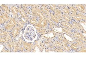 Immunohistochemistry (IHC) image for anti-Perilipin 2 (PLIN2) (AA 5-232) antibody (ABIN7433519)