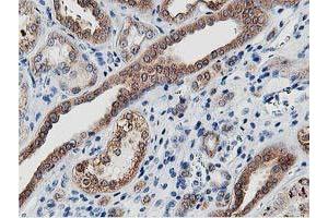 Image no. 8 for anti-Leucine Carboxyl Methyltransferase 1 (LCMT1) antibody (ABIN1499107) (LCMT1 抗体)