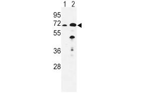Western Blotting (WB) image for anti-Enoyl-CoA, Hydratase/3-Hydroxyacyl CoA Dehydrogenase (EHHADH) antibody (ABIN3003844) (EHHADH 抗体)