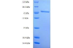 SDS-PAGE (SDS) image for Acetyl-CoA Acyltransferase 1 (ACAA1) (AA 27-331) protein (His tag) (ABIN5708987)