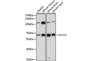 Western blot analysis of extracts of various cell lines, using GLCCI1 antibody (ABIN7267395) at 1000 dilution. (GLCCI1 抗体  (AA 120-230))