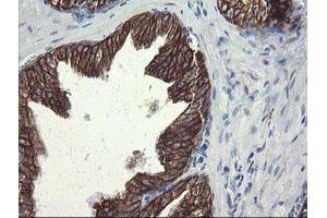 Image no. 5 for anti-Src-like-adaptor 2 (SLA2) antibody (ABIN1500949)