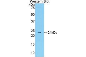 Detection of recombinant GPC1 using Polyclonal Antibody to Glypican 1 (GPC1) (GPC1 抗体  (AA 343-545))