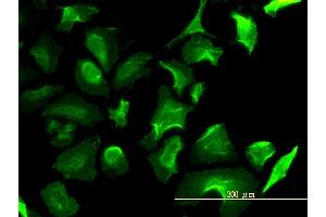 Immunofluorescence of monoclonal antibody to LDHB on HeLa cell. (LDHB 抗体  (AA 1-334))