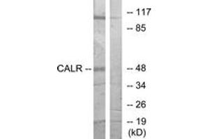 Western blot analysis of extracts from COS7 cells, using CALR Antibody. (Calreticulin 抗体  (AA 21-70))