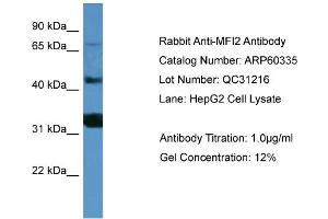 WB Suggested Anti-MFI2  Antibody Titration: 0. (MFI2 抗体  (C-Term))