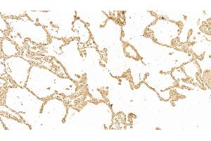 Detection of GAL3 in Human Lung Tissue using Monoclonal Antibody to Galectin 3 (GAL3) (Galectin 3 抗体  (AA 1-250))