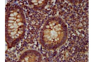 IHC image of ABIN7147311 diluted at 1:400 and staining in paraffin-embedded human appendix tissue performed on a Leica BondTM system. (CDCA7L 抗体  (AA 14-167))