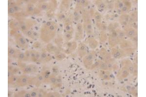 Immunohistochemistry (IHC) image for anti-Microseminoprotein, beta (MSMB) (AA 19-114) antibody (ABIN1175773)