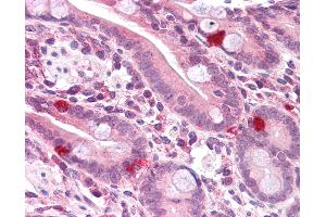 Immunohistochemistry (IHC) image for anti-Phosphatidic Acid Phosphatase Type 2 Domain Containing 2 (PPAPDC2) (C-Term) antibody (ABIN605140)