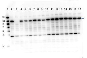 Western Blotting (WB) image for anti-Poly (ADP-Ribose) Polymerase 1 (PARP1) (C-Term) antibody (ABIN5596914)