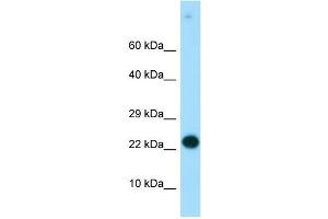WB Suggested Anti-RGS19 Antibody Titration:  0. (RGS19 抗体  (N-Term))
