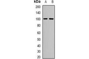 Western blot analysis of Neutral Ceramidase expression in mouse kidney (A), mouse heart (B) whole cell lysates. (ASAH2 抗体)