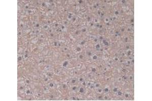 IHC-P analysis of Human Liver Tissue, with DAB staining. (TLR5 抗体  (AA 693-858))