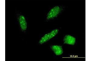 Immunofluorescence of monoclonal antibody to RNF24 on HeLa cell. (RNF24 抗体  (AA 49-148))