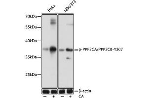Western blot analysis of extracts of various cells, using Phospho-PPP2CA/PPP2CB-Y307 antibody (ABIN7269685) at 1:1000 dilution. (PPP2CB 抗体  (pTyr307))
