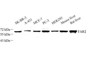 Western blot analysis of FAR2 (ABIN7073924) at dilution of 1: 500