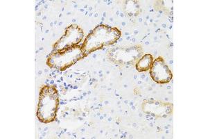 Immunohistochemistry of paraffin-embedded rat kidney using MYO5A antibody. (MYO5A 抗体)