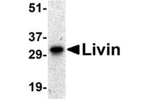 Western Blotting (WB) image for anti-Baculoviral IAP Repeat-Containing 7 (BIRC7) antibody (ABIN1031705) (BIRC7 抗体)