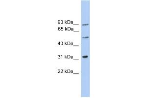 WB Suggested Anti-C6orf182 Antibody Titration: 0. (CEP57L1 抗体  (Middle Region))