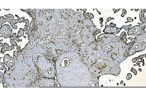 IHC analysis of DNAJC10 using anti-DNAJC10 antibody (ABIN7601358).