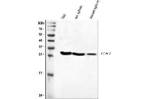 Western blot analysis of CA1 using anti-CA1 antibody (ABIN3043766).
