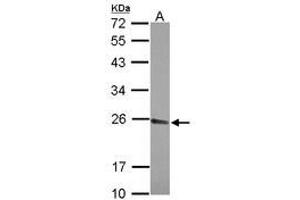 Image no. 1 for anti-Cleavage and Polyadenylation Specific Factor 4, 30kDa (CPSF4) (AA 31-216) antibody (ABIN1497600) (CPSF4 抗体  (AA 31-216))