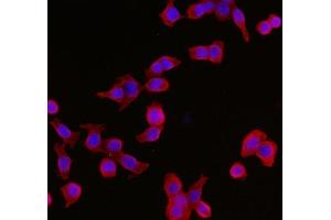 IF analysis of YWHAE using anti-YWHAE antibody (ABIN7599165).
