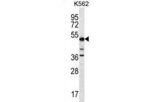 Western Blotting (WB) image for anti-Proline-serine-threonine Phosphatase Interacting Protein 1 (PSTPIP1) antibody (ABIN2996784) (PSTPIP1 抗体)