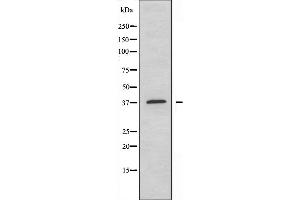 Western blot analysis of extracts from HepG2 cells using EFNA3 antibody. (Ephrin A3 抗体  (C-Term))