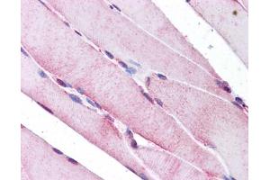 Immunohistochemistry (IHC) image for anti-Selenoprotein N, 1 (SEPN1) (C-Term) antibody (ABIN2773903) (SEPN1 抗体  (C-Term))