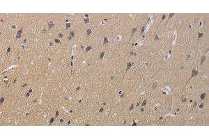 Immunohistochemistry (Paraffin-embedded Sections) (IHC (p)) image for anti-Potassium Large Conductance Calcium-Activated Channel, Subfamily M, beta Member 4 (KCNMB4) antibody (ABIN7239140)