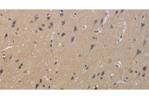 Immunohistochemistry of paraffin-embedded Human brain using KCNMB4 Polyclonal Antibody at dilution of 1:40 (KCNMB4 抗体)