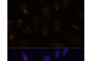 Immunofluorescence analysis of U-2 OS cells using FoxO3a Polyclonal Antibody at dilution of 1:100. (FOXO3 抗体)