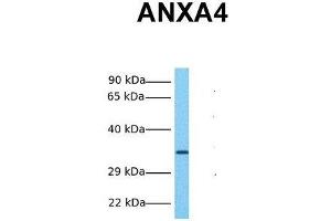 Host:  Rabbit  Target Name:  ANXA4  Sample Tissue:  Human Fetal Liver  Antibody Dilution:  1. (Annexin IV 抗体  (N-Term))